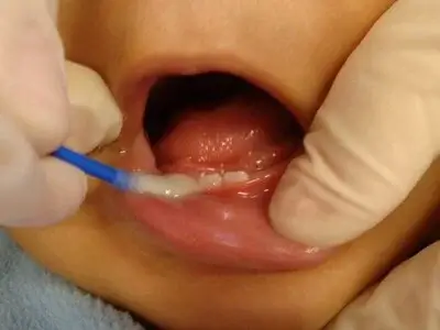 child dentist