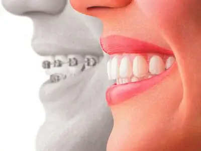 Cosmetic Dentistry