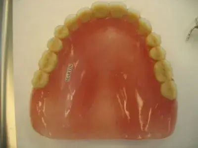 Dentures